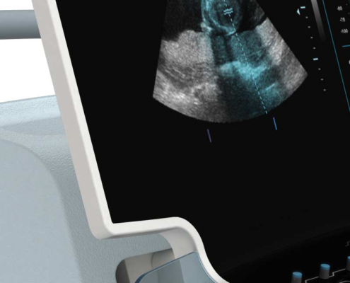 Vorschau XS Ultrasound Designstudie Rendering 03 495x400